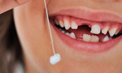 Вырвать молочный зуб в домашних условиях