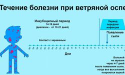 Ветрянка у детей как передается