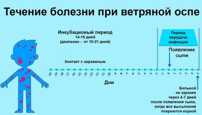 Ветрянка у детей как передается