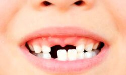 Сколько зубов меняется у ребенка