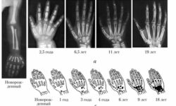 Точки окостенения у детей